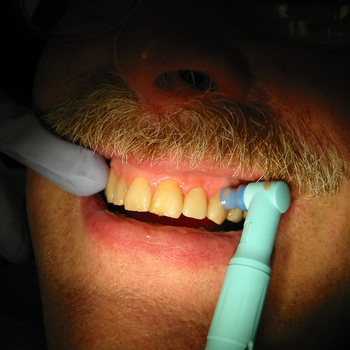 Turkey Dental Check-Up 2026: Cleaning, Polishing & Screening from $600 - Turkey travel guide, tips and tour insights | My Turkey Adventure